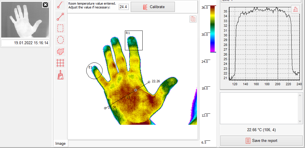 Thermography thermal profile 2
